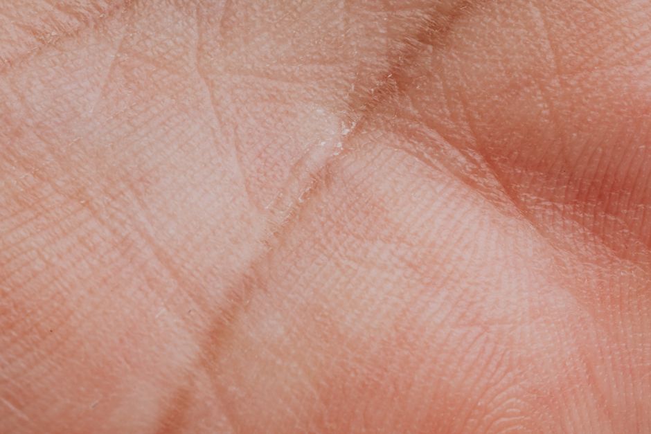 Macro shot of healthy skin showing intact barrier layers, representing resilient sensitive skin.